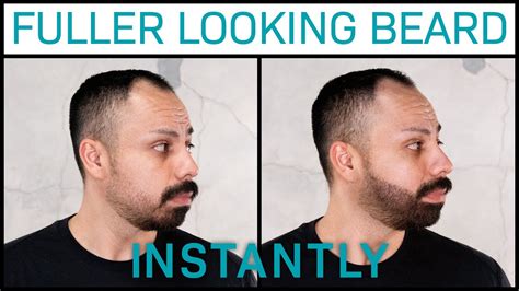 The Ultimate Solution for Patchy Beards: Magic Beard Filler